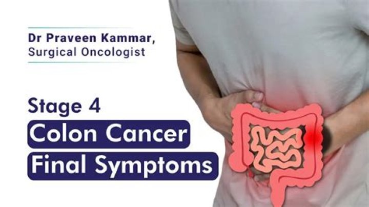 Pioneer Woman Colon Cancer Stage 4: A Comprehensive Guide